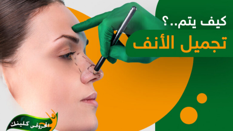 How is rhinoplasty done?