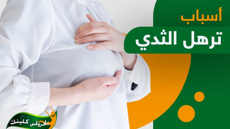 Causes of sagging breasts