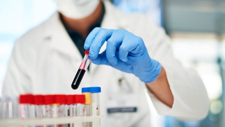 Global Haemato Oncology Testing Market Size Share Key Players Demand Growth Analysis Research Report