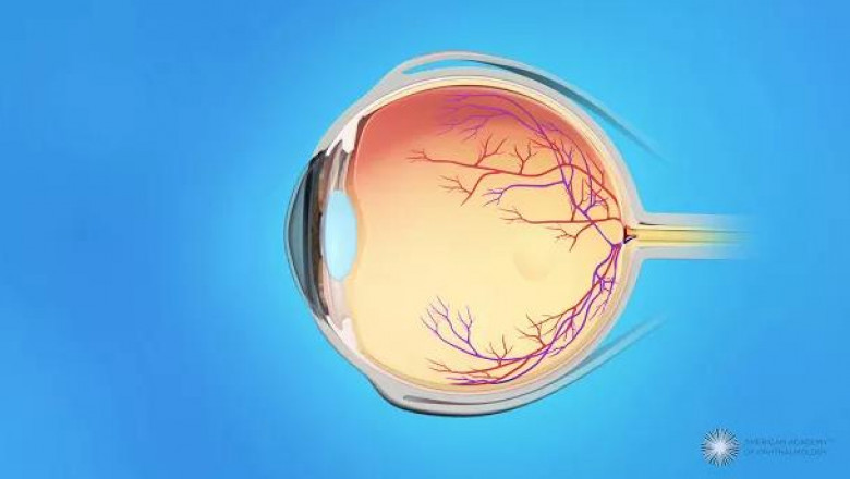 Questions To Ask Your Ophthalmologist