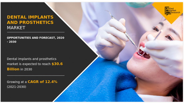 Latest Study on Dental Implants and Prosthetics Market hints a True Blockbuster