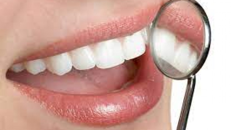 Which Type of Teeth Cleaning is Best?