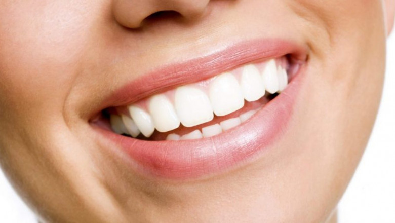 What Is The Difference: Veneers Vs. Lumineers?