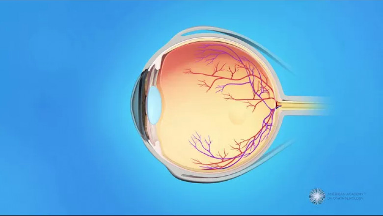 Concerns to Consider When Selecting an Eye Specialist