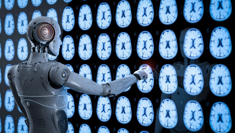 AI-enabled X-Ray Imaging Solutions Market Global Industry Analysis and Forecast 2021-2027