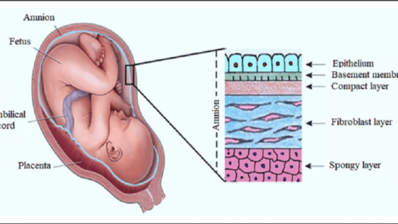 Amniotic Membrane Market Share, Size and Industry Growth Analysis 2022-2027