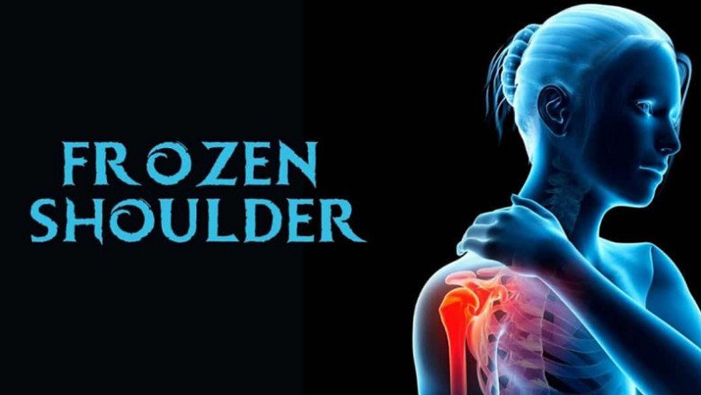 PHYSIOTHERAPY TREATMENT FOR ADHESIVE CAPSULITIS