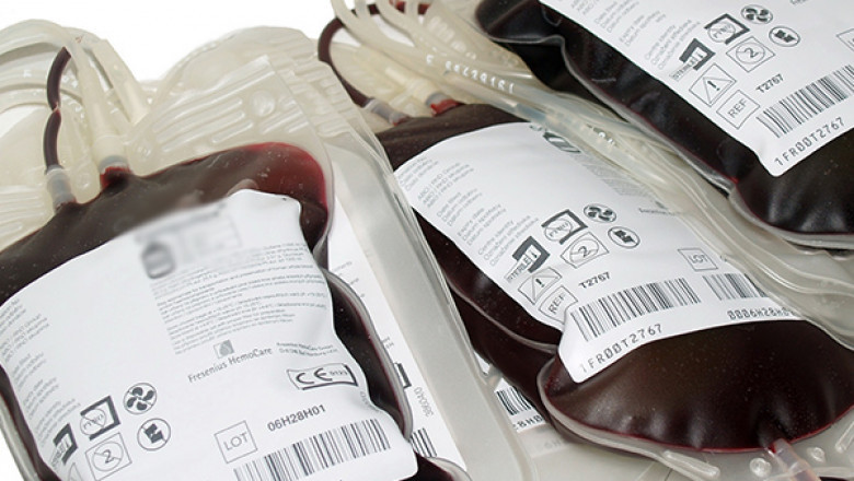 A Disposable Blood Bag Is Used For Collecting, Storing, Transporting, And Transfusing Human Blood