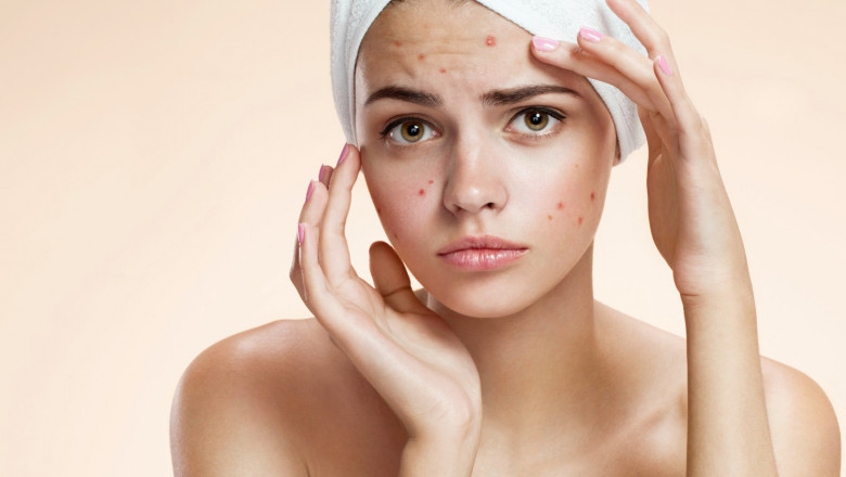 Anti-Aging Ingredients - Unani Medicine For Skin Aging?