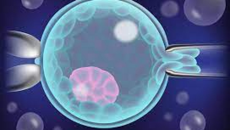 Preimplantation Genetic Testing Market Size, In-depth Analysis Report and Global Forecast to 2028