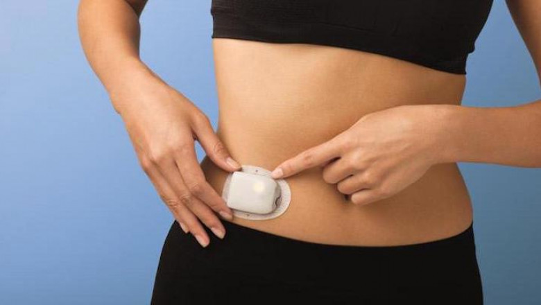 Tubeless Insulin Pump Users Occasionally Encounter Minor Issues With Them