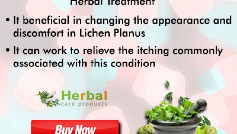 8 Home Remedies To Get Rid Of Lichen Planus