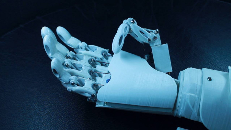 Medical Bionic Implants Replicate an Organ's Original Function or Even Outperform It