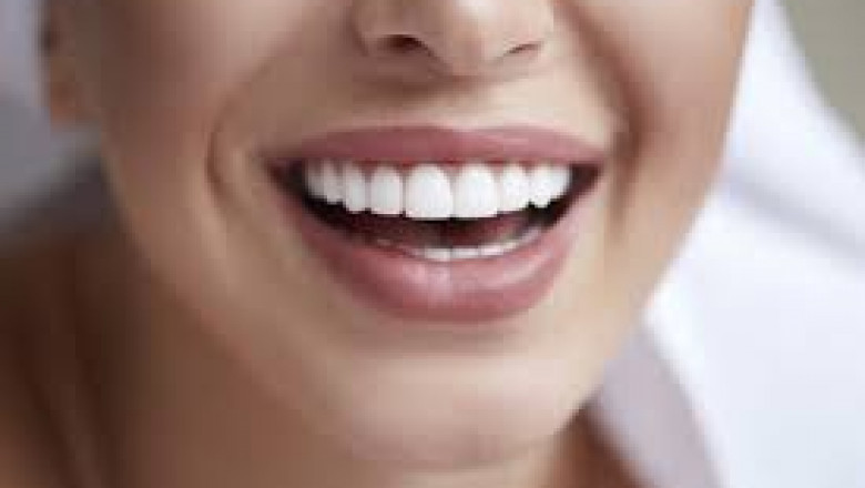 How Long Do All-on-4 Implants Last?