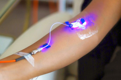 Global Blood Irradiation Market Report, Latest Trends, Industry Opportunity & Forecast to 2028