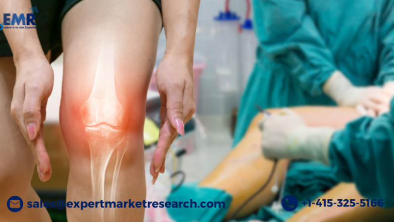 Global Knee Cartilage Repair Market to be Driven by Increasing Prevalence of Knee Injuries in the Forecast Period of 2022-2027