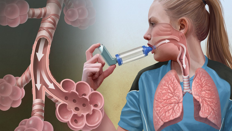 Adrenergic Receptor Agonists - Unani Powerful Medications For Asthma Treat?
