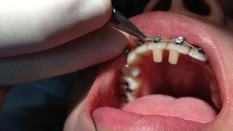 What Do You Look for in a Pediatric Dentist?