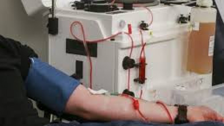 Plasmapheresis Market 2022 Business Growth, Analysis, Demand, Future Forecast 2028