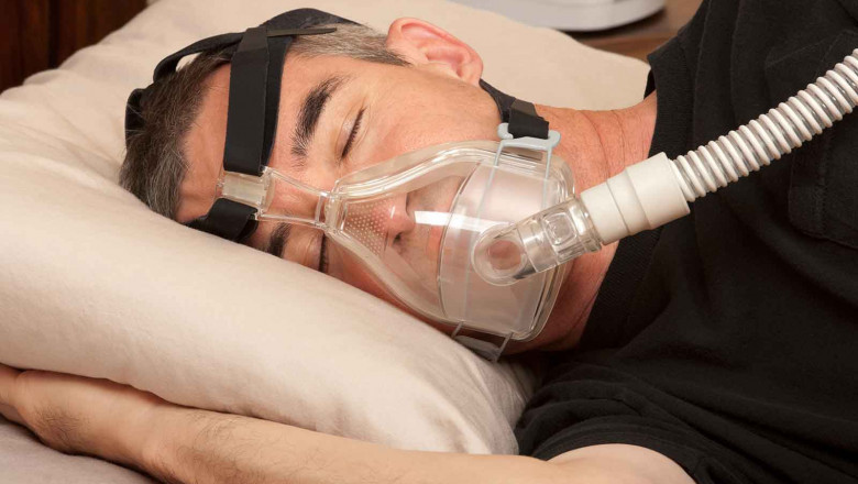 Sleep apnea disorders can be treated with Continuous Positive Airway Pressure (CPAP) Interface Devices