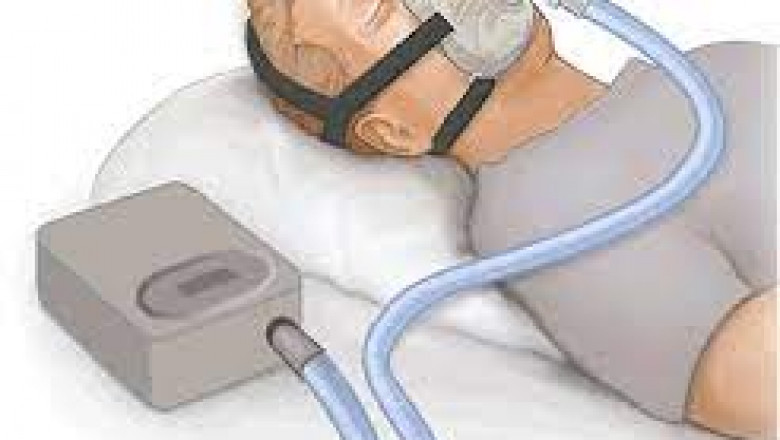 Sleep apnea disorders treated with Continuous Positive Airway Pressure (CPAP) Interface Devices