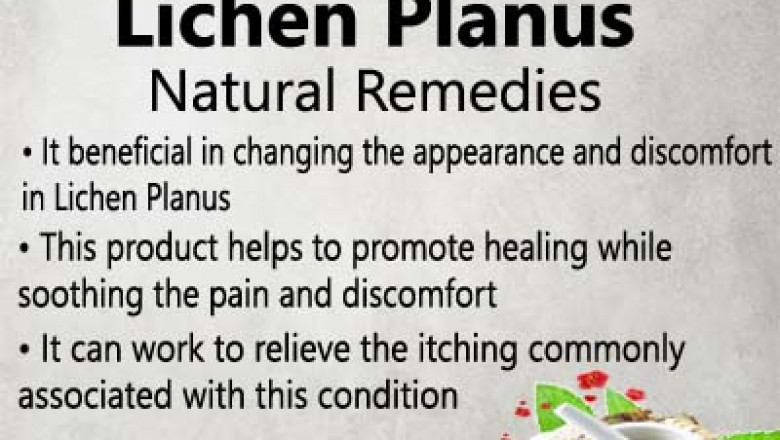 Cure Your Lichen Planus with Simple Home Remedies and Treatment