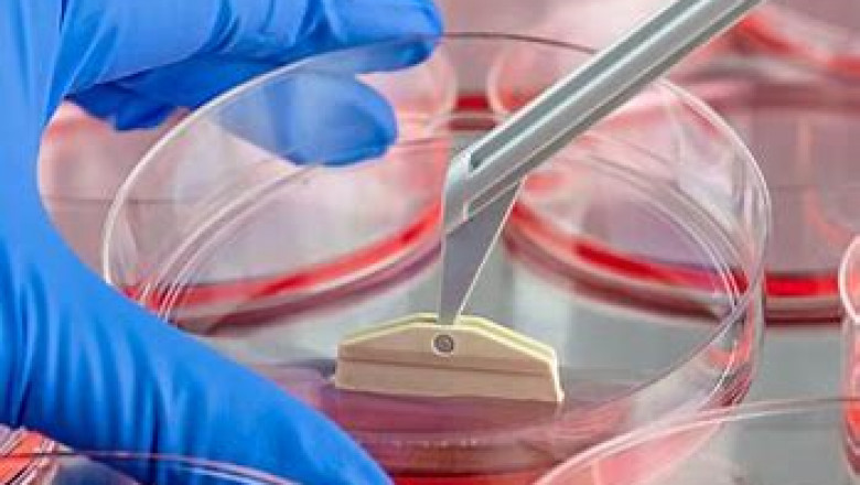 Cell Harvesting System Market 2022 New Opportunities, Dynamics With Financial Facts By 2028