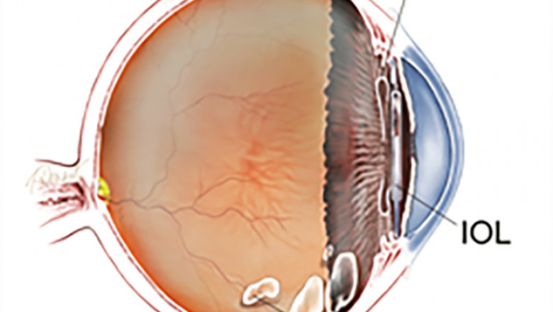 Why Go See a Specialist in Eyes?