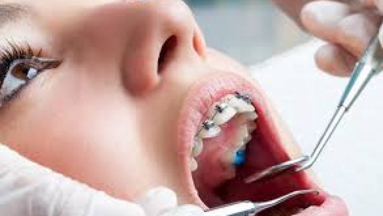 Why You Need Orthodontics for Your Child – The Best Orthodontist in Brooklyn