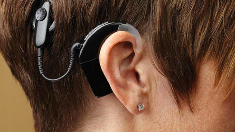 Points to Do after Cochlear Implant in Singapore