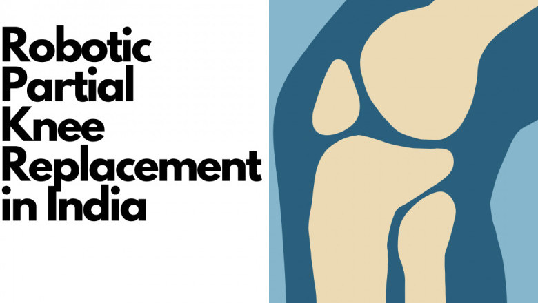 Partial Knee Replacement Doctor in Jaipur