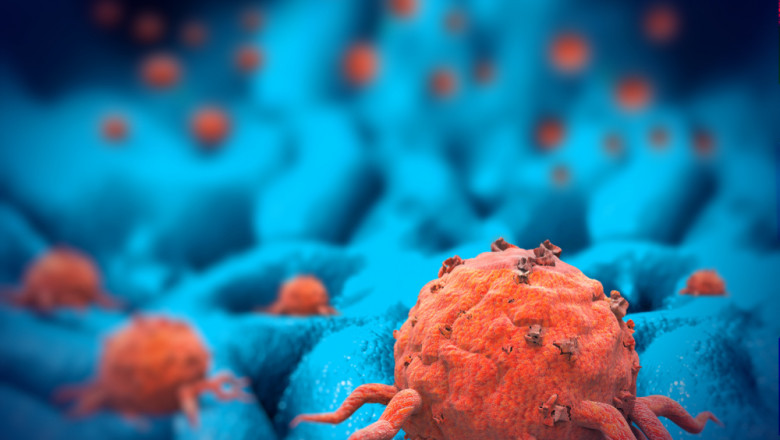 Statistical forecasts for the global oncology biosimilar market for the years 2022-2028.