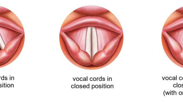 Vocal Cord Paralysis Market 2022 Research Report with Opportunities and Strategies to Boost Growth- COVID-19 Impact and Recovery~
