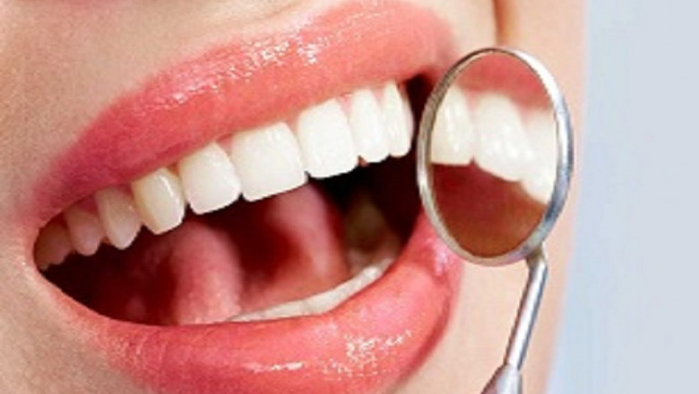 What Exactly Is Gingivitis?