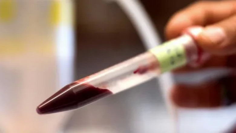 Artificial Blood Market Global Industry Analysis, Size, Share, Growth, Trends and Forecast 2022-2028