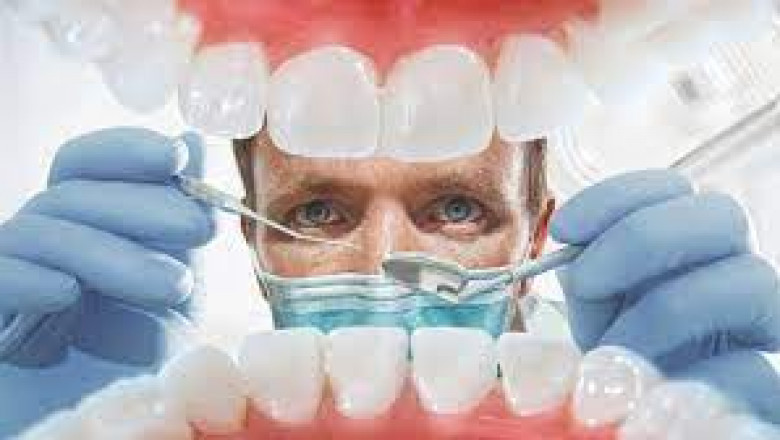 Practical ways to handle impacted wisdom teeth