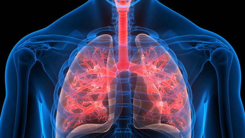 Global Infectious Respiratory Disease Diagnostics Market Report, Latest Trends, Industry Opportunity & Forecast to 2028