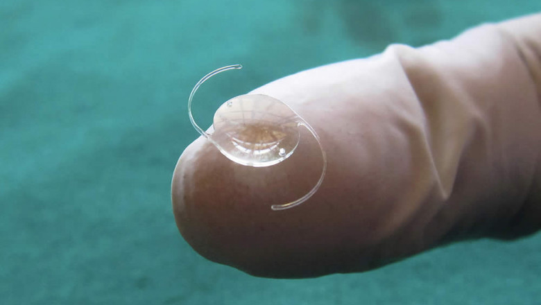 Recent Development in Massive Intraocular Lenses Market 2029 Booming Worldwide