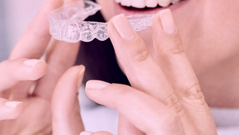 What Are the Best Teeth Aligners in the UK?