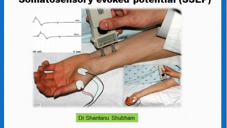 Somatosensory evoked potential (SSEP) - Dr.Shantanu Shubham