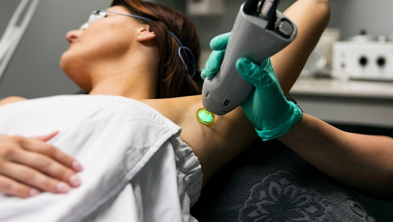 Laser Clinic Bundoora | Laser Hair Removal - Fresh Skin Canvas
