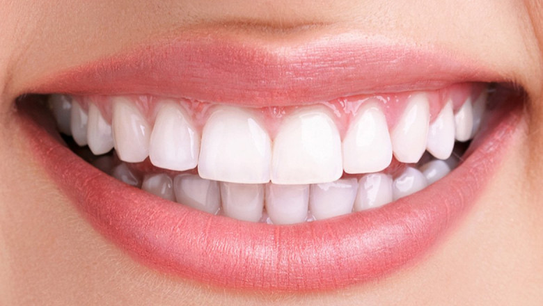 Three Reasons to Visit Smiles On 35th for Dental Treatments