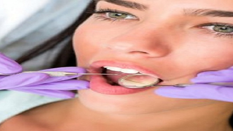 What Should You Eat After a Root Canal Treatment?