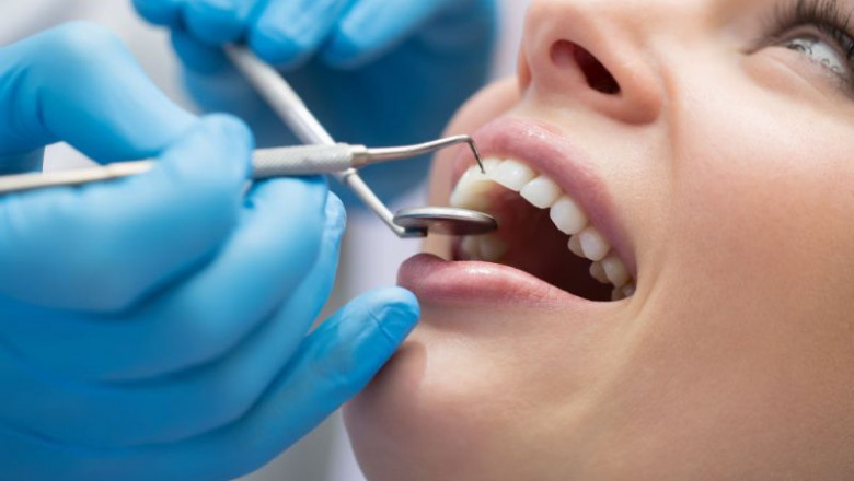Ideas To Choose The Best Dental Clinic