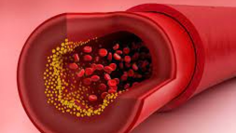 Vascular Prostheses Market Size, In-depth Analysis Report and Global Forecast to 2028