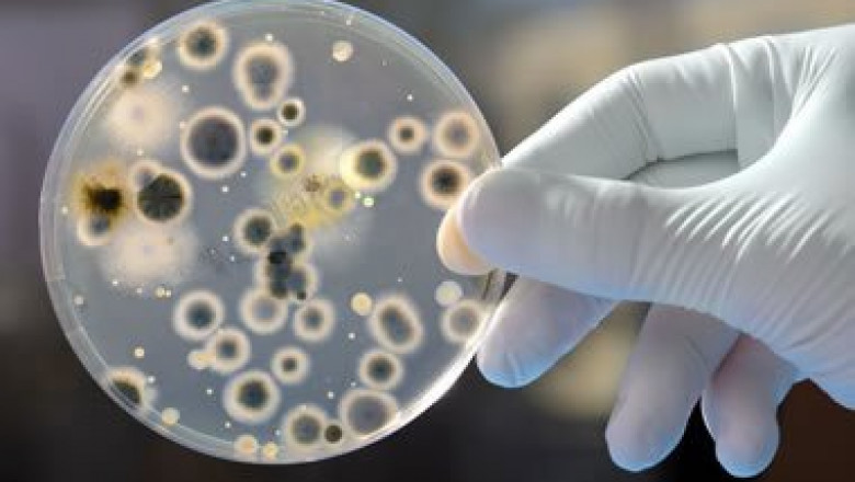 Legionella testing