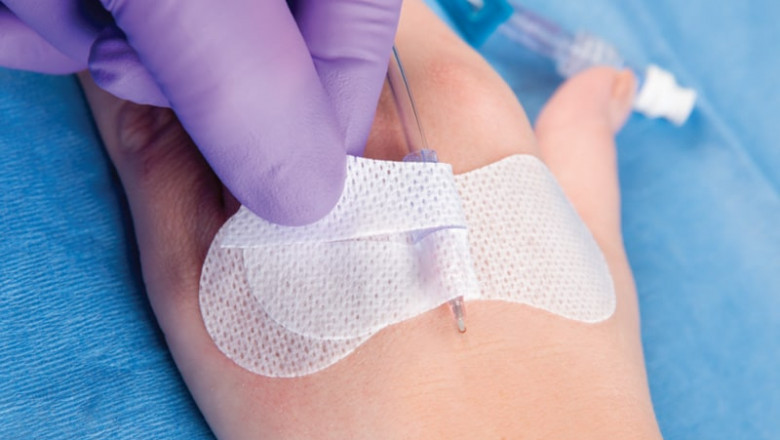 The Catheter Stabilization Devices Market: Global industry trends, share, size, growth, opportunities, and forecasts for 2022-2028