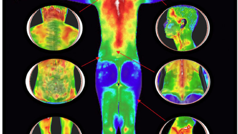 There Are Several Advantages To Using Near Infrared Medical Imaging Over Other Radio-Imaging Techniques Currently Available