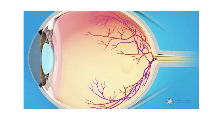 Things to Keep in Mind When Consulting an Eye Specialist
