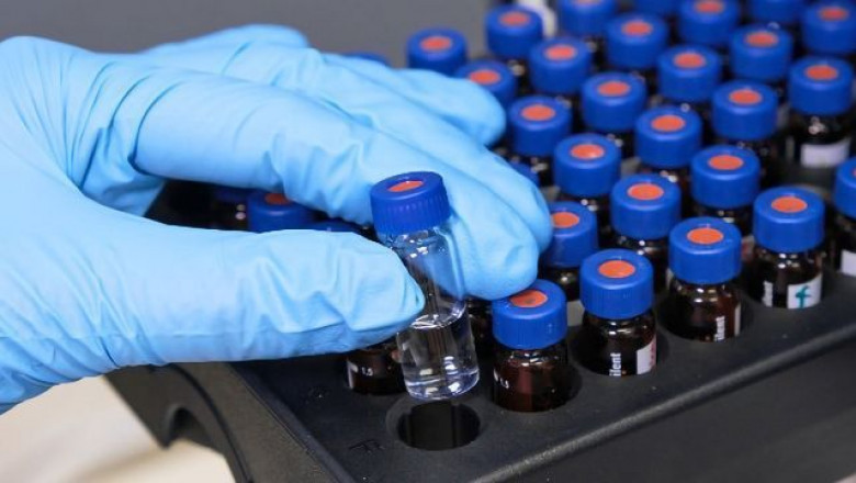 To Minimize Sample Diffusion, Liquid Chromatography Involves Introducing The Sample On Or Very Close To The Column